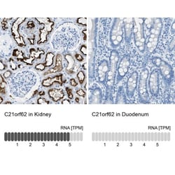 C21orf62 Antibody, Novus Biologicals 25 &mu;L; Unlabeled:Antibodies, Polyclonal